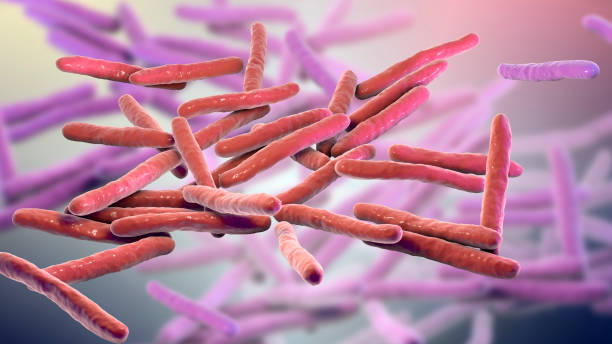 La lepra es causada por el bacilo Mycobacterium leprae, que se transmite por microgotas de la nariz y boca de personas contagiadas. Foto: Getty Images.