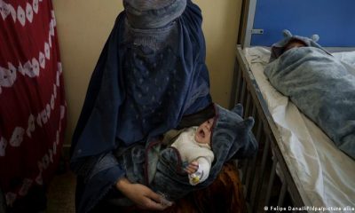 Una mujer con su hijo en un centro de atención a menores desnutridos en Afganistán. Foto: Picture Aliance.