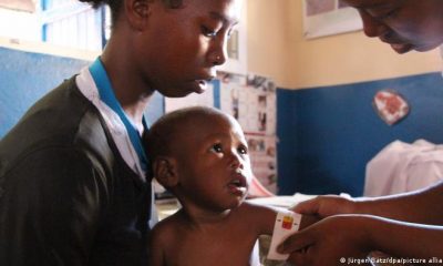 Un empleado de una organización de ayuda humanitaria mide la circunferencia del brazo de un niño desnutrido en Madagascar. Foto: Picture Aliance.