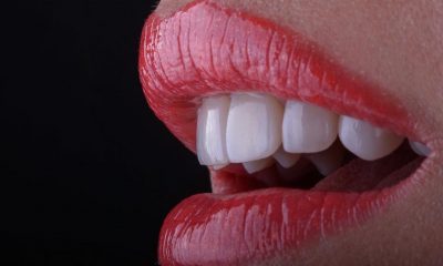 Boca sana y bella, gracias a los avances de la Odontología Estética. Foto: Zanon Dental Art.