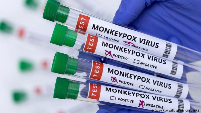 Test de la viruela del mono. Foto: DW