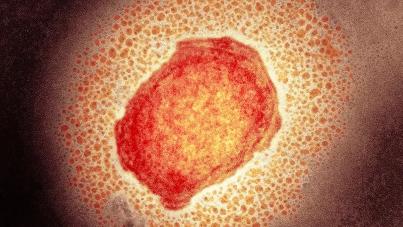 Partícula del virus del mono. Foto: BBC Mundo.