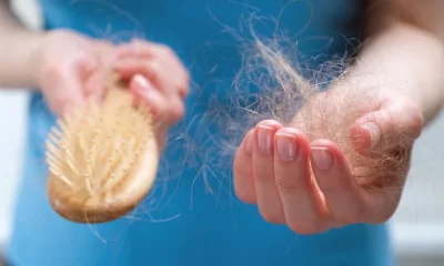 “35 pacientes con alopecia areata severa participaron en los ensayos clínicos que demostraron que el baricitinib es un medicamento seguro y eficaz para tratar su trastorno. Foto: Infobae