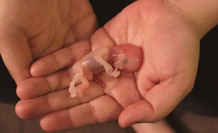 El aborto reduce las posibilidades de ser madre a posteriori. Foto: Actual.com.