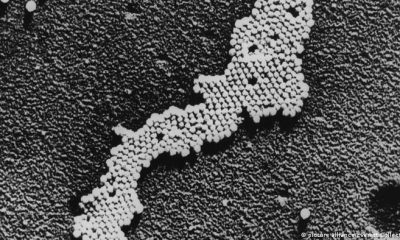 Imagen aumentada del poliovirus. Foto: DW