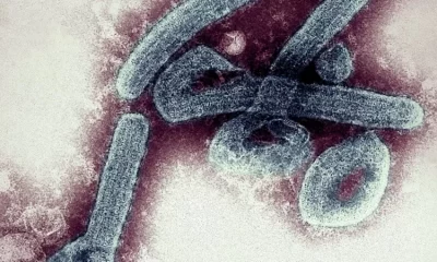 El virus de Marburgo se detectó por primera vez en la ciudad de Marburgo, en Alemania, en 1967. Foto: BBC Mundo