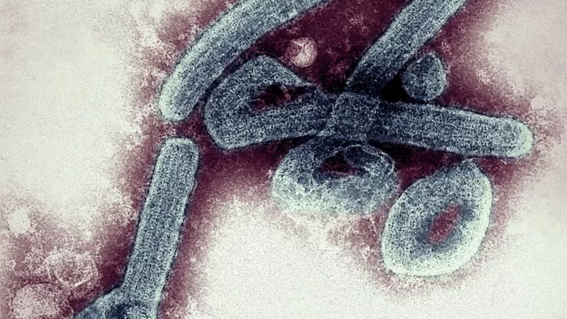 El virus de Marburgo se detectó por primera vez en la ciudad de Marburgo, en Alemania, en 1967. Foto: BBC Mundo