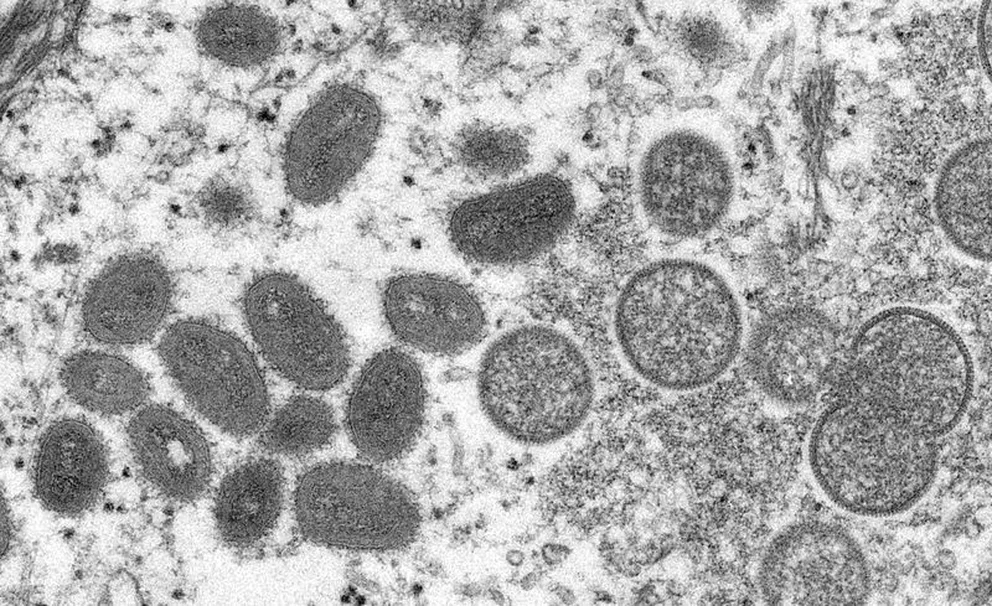 Una imagen tomada mediante un microscopio electrónico muestra partículas ovales de virus maduros de viruela del mono. Foto: Infobae