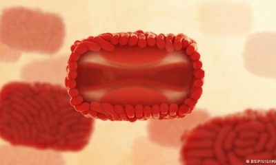 Viriones de la viruela del mono: la partícula en primer plano se muestra en una vista recortada, revelando su núcleo interno en forma de campana, que contiene el ADN del virus. Foto: DW