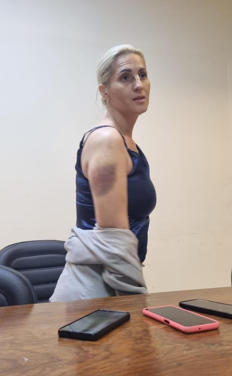 La mujer fue víctima de agresión y robo por parte de los agentes policiales. Foto: Gentileza.