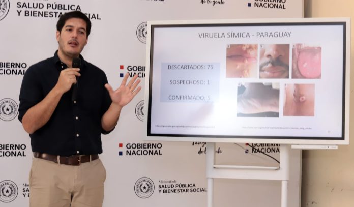 El director de Vigilancia de la Salud, Guillermo Sequera este viernes en el curso de la conferencia epidemiológica. Foto: Agencia IP