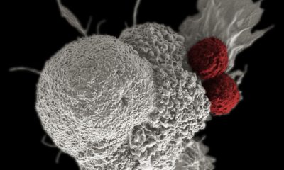 Linfocitos T citotóxicos, en rojo, atacan a células cancerosas, en blanco. Foto: El País