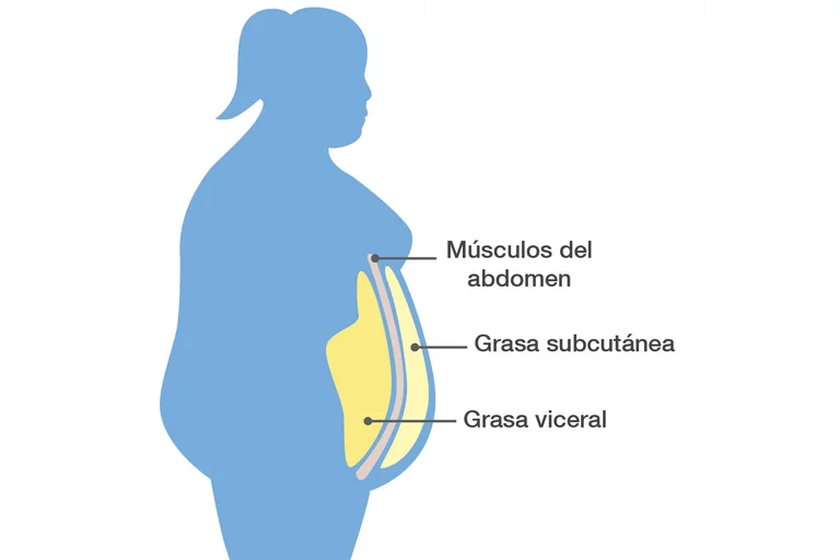 La grasa superficial se correlaciona con un mejor control glucémico e índices de salud cardiovascular, y la grasa visceral se correlaciona con presión arterial alta, obesidad y resistencia a la insulina. Foto: Infobae