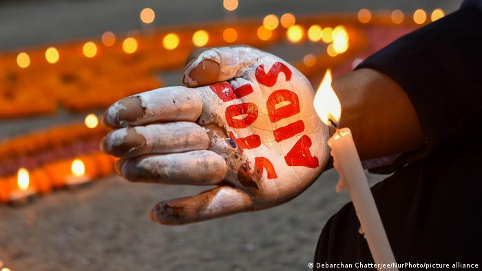 Más de 38 millones de personas viven actualmente con el virus del VIH en todo el mundo, de acuerdo con cifras de la ONU. Foto: DW