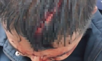 El policía interviniente quedó con varias heridas. Foto: Policía Nacional.