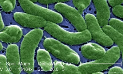 Una imagen microscópica del Vibrio vulnificus. Foto: DW.