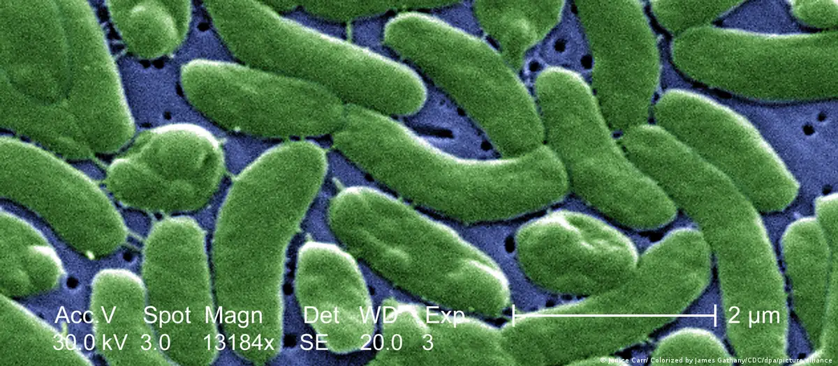 Una imagen microscópica del Vibrio vulnificus. Foto: DW.