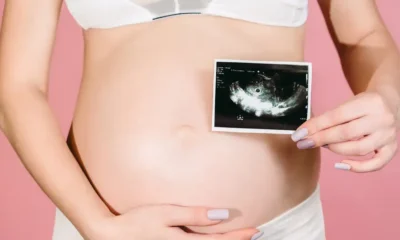 Mujer embarazada muestra una imagen de su ultrasonido. Foto referrencial. DW.