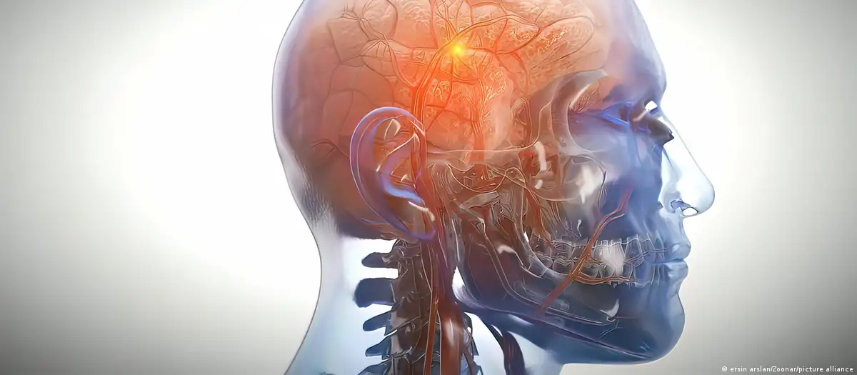 Las estimaciones mundiales en 2019 mostraban que más de 8,5 millones de personas padecían Parkinson, según datos de la OMS. Foto: DW.