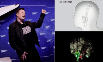 Elon Musk, anunció este lunes que su compañía, Neuralink, realizó con éxito la primera implantación de un chip cerebral en un ser humano. Foto: Infobae.