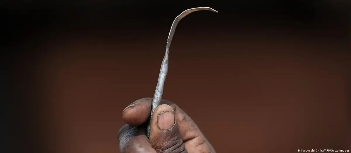 En Somalia, 99% de las mujeres entre 15 y 49 años fueron sometidas a la mutilación genital. Foto: DW.