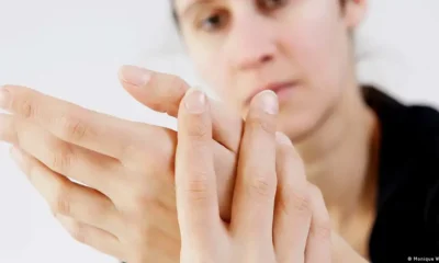 Las manos duelen y se vuelven rígidas, la inflamación reumática puede afectar a todo el cuerpo. Foto: DW.