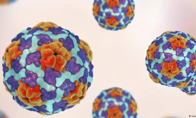 Virus causante de la hepatitis AImagen: imago images/Science Photo Library PUB