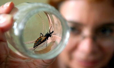 El Chagas es una enfermedad parasitaria altamente mortal. Foto: Revista Ciencia.