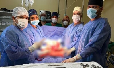 Extirpan enorme tumor a una mujer en Mariscal Estigarribia. Foto: MSP BS.