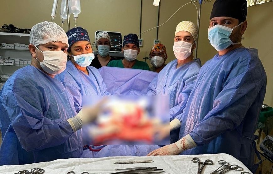 Extirpan enorme tumor a una mujer en Mariscal Estigarribia. Foto: MSP BS.