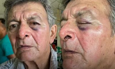 Anciano quedó brutalmente golpeado. Foto: Captura.