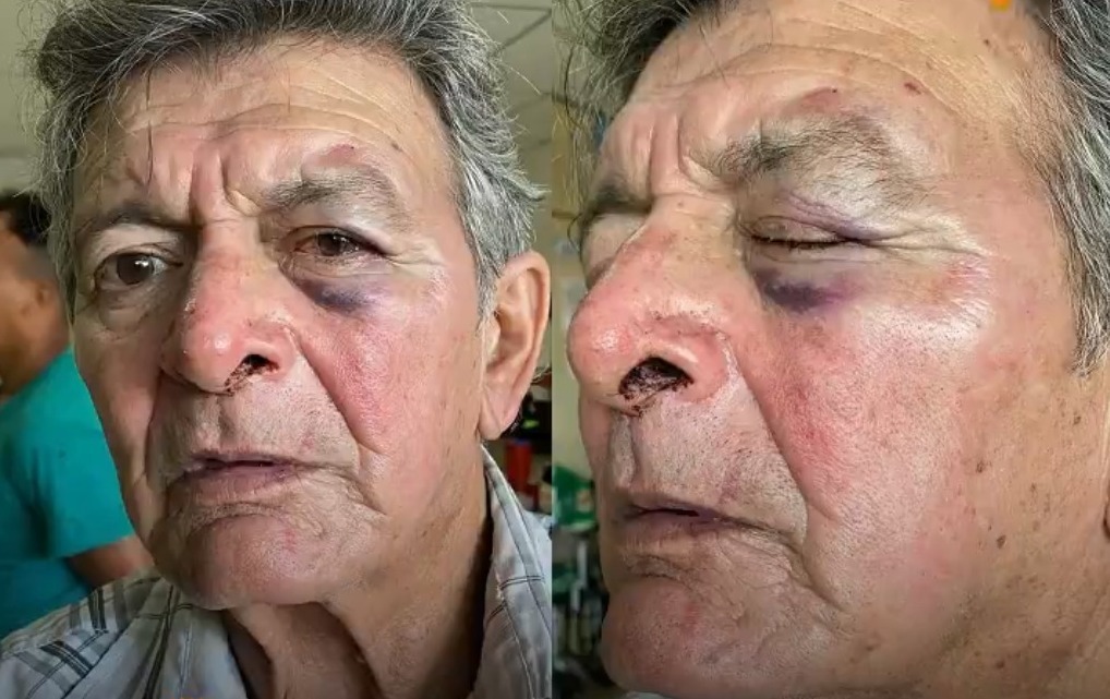 Anciano quedó brutalmente golpeado. Foto: Captura.