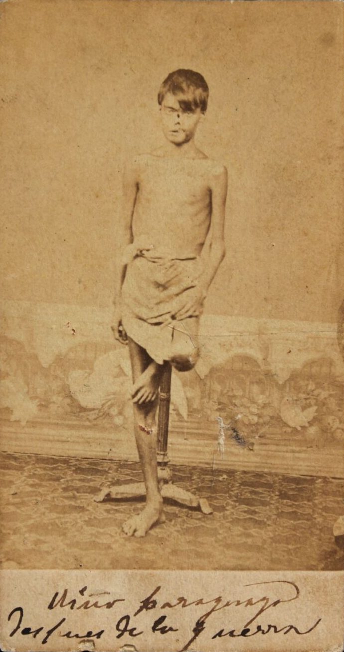 Niño paraguayo después de la guerra. Fotógrafo no identificado, cerca de 1868. Museo Histórico Nacional, Buenos Aires, Argentina