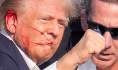 Donald Trump herido en la oreja tras el atentado.