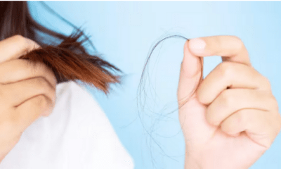 Caída de cabello en mujeres. Foto: Infoabe.