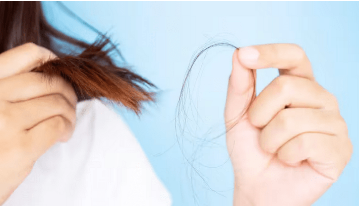 Caída de cabello en mujeres. Foto: Infoabe.