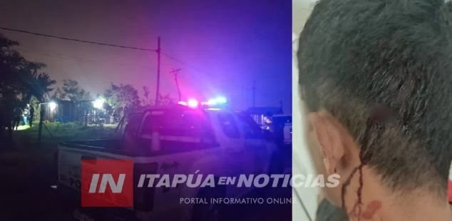 El hombre quedó herido. Foto: Itapúa en Noticias.