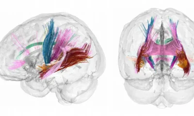 Nuevos escáneres cerebrales muestran cómo cambia el cerebro de una madre durante el embarazo. Imagen: Daniela Cossio