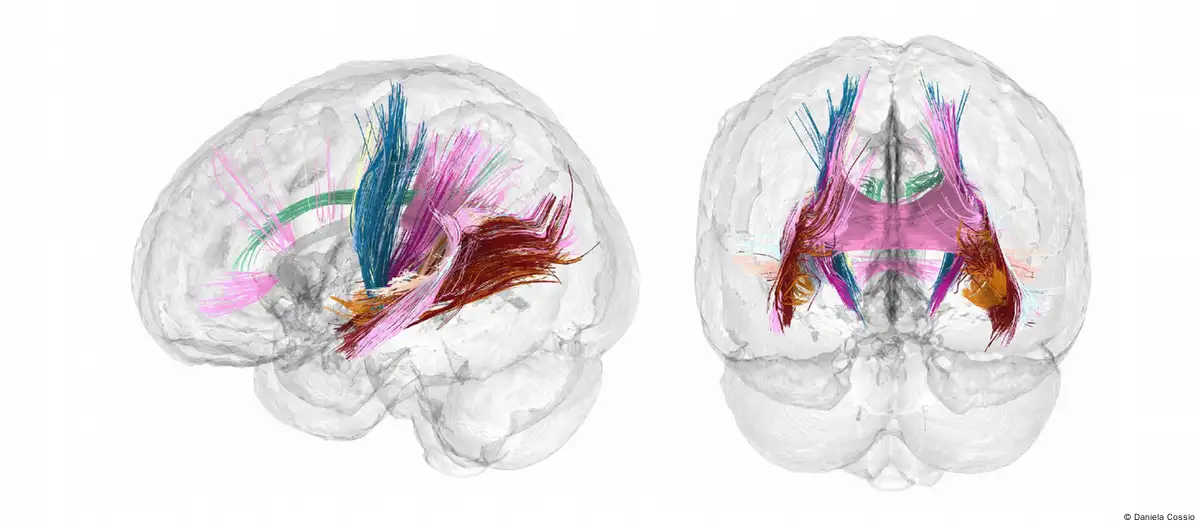 Nuevos escáneres cerebrales muestran cómo cambia el cerebro de una madre durante el embarazo. Imagen: Daniela Cossio