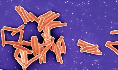 La bacteria Mycobacterium tuberculosis causa la tuberculosis y es uno de los patógenos más peligrosos del mundo. Imagen: NIH-NIAID/IMAGE POINT/BSIP/picture alliance