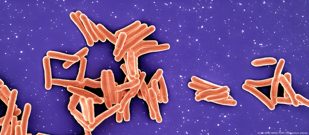 La bacteria Mycobacterium tuberculosis causa la tuberculosis y es uno de los patógenos más peligrosos del mundo. Imagen: NIH-NIAID/IMAGE POINT/BSIP/picture alliance