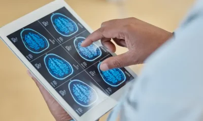 Imagen de archivo: un médico examina los rayos X de un cerebro humano. Imagen: Pond5 Images/IMAGO