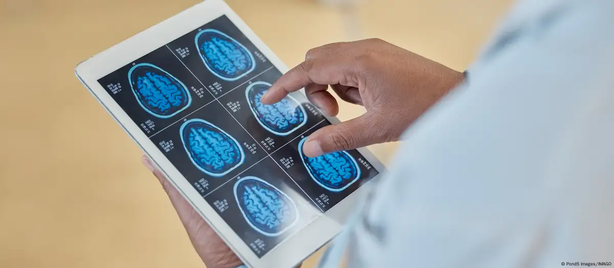 Imagen de archivo: un médico examina los rayos X de un cerebro humano. Imagen: Pond5 Images/IMAGO