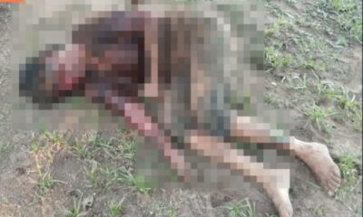 La mujer quedó gravemente herida. Foto: Gentileza.