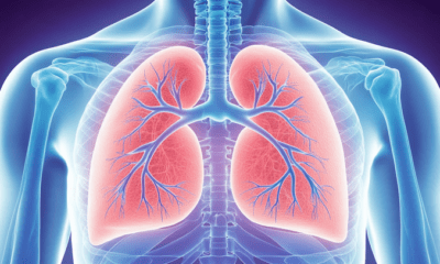 Las vías respiratorias dañadas y las infecciones pueden convertirse en un círculo vicioso: cada infección provoca más daños en las vías respiratorias y, con el tiempo, pierden la capacidad de introducir y expulsar el aire (Imagen Ilustrativa Infobae)